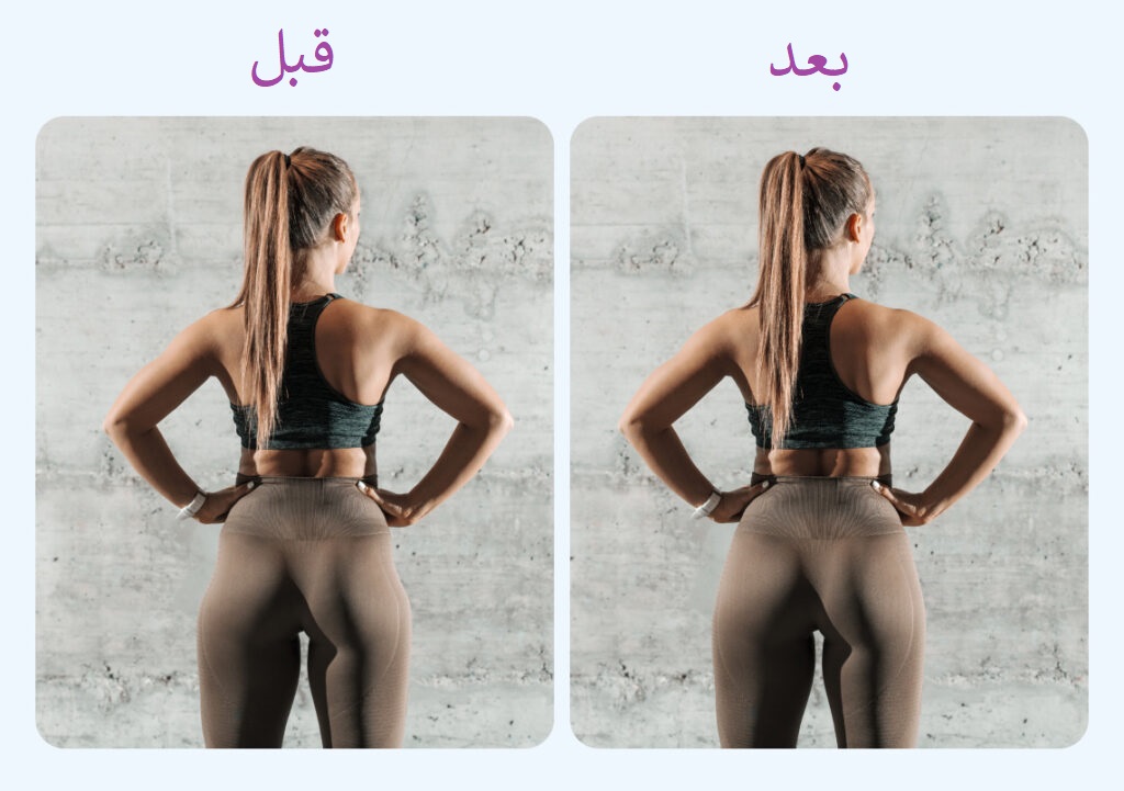 برنامه بدنسازی 10 هفته ای برای رفع هیپ دیپ در بانوان 3 هیپ دیپ قبل و بعد